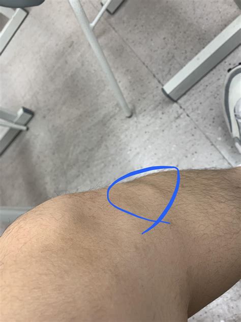 Pain Under.knee Cap at Christine Scheerer blog