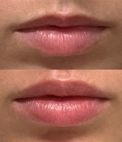 5 best u/supersharky64 images on Pholder | Covetfashion, Plastic Surgery and Zelda