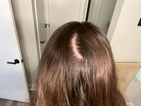 Have any of you experienced this issue of your hair parting/cracking ...