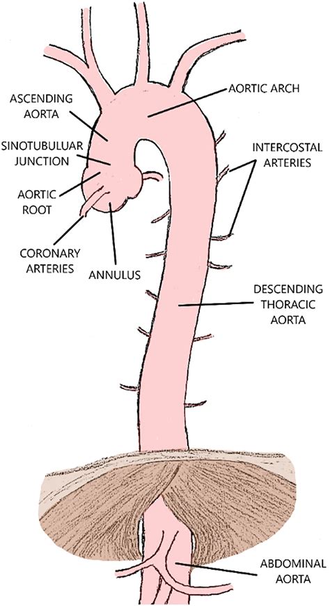 Thoracic Aortic Aneurysms and Arch Disease - Surgical Clinics