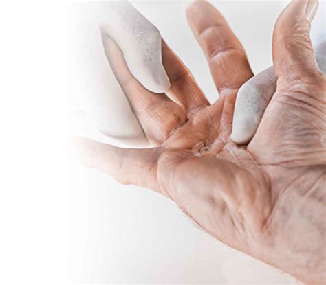 Xiaflex Injection (Dupuytren’s Contracture) - Katy Hand Surgery - Houston, TX