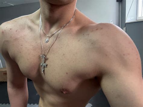 do i have gyno? | Looksmax.org - Men's Self-Improvement & Aesthetics