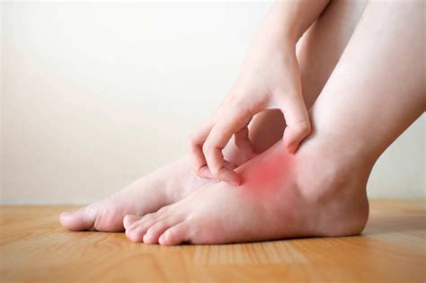 Why Are My Feet Itchy