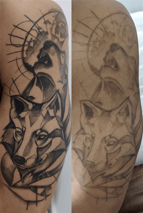 How much does tattoo removal hurt compared to getting a tattoo? : r/TattooRemoval