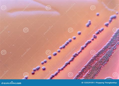 Escherichia Coli Colony Morphology
