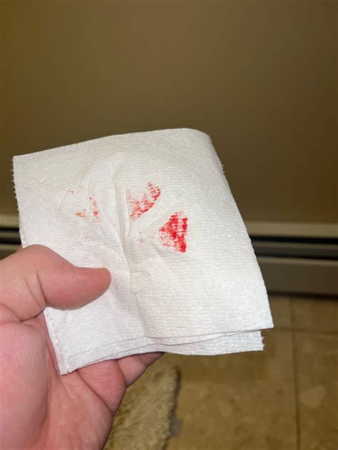 Blood after wiping… pushed to hard a few nights ago because of constipation, been wondering if ...