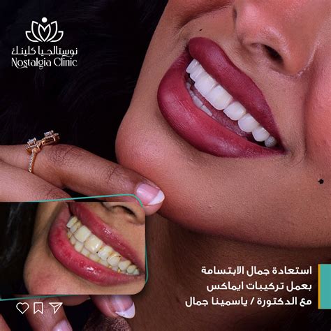 د/ ياسمينا جمال – Nostalgia clinic