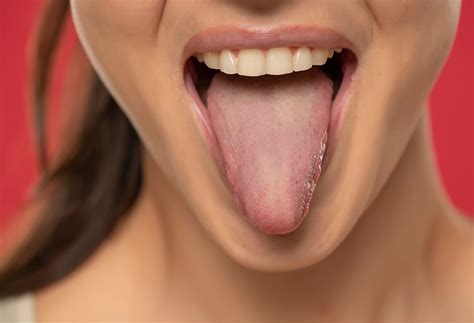 What Does A Healthy Tongue Look Like? | The Well by Northwell