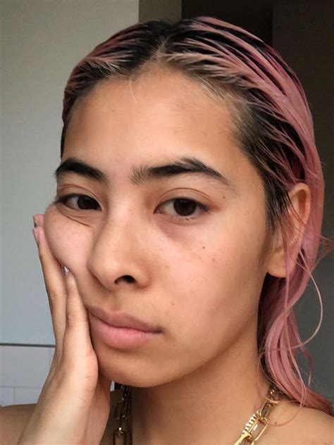 Laser Skin Tightening: Everything You Need to Know | Who What Wear