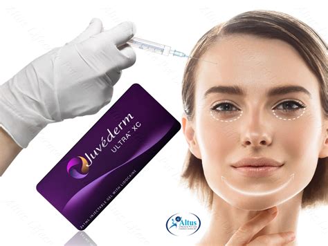 Juvederm Ultra XC: Unleash Your Natural Beauty 1