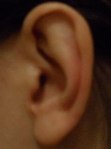 How to Treat an Itchy Ear Canal | Itchy ear canal, Itchy ears, Health ...