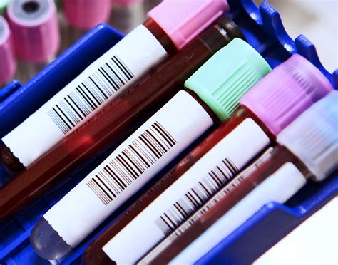 Luteinizing hormone (LH) blood test