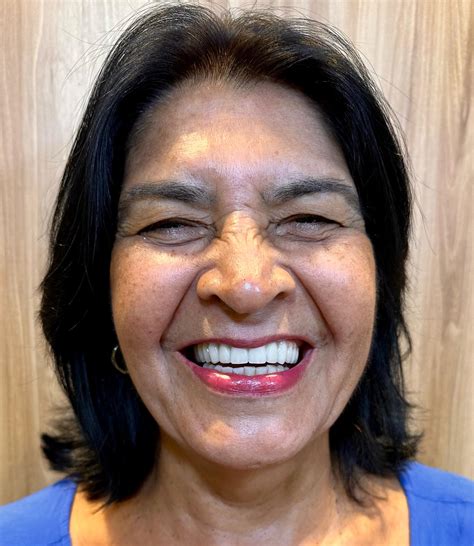 Dra. Ilanna Castro | Implante e prótese Salvador | Em janeiro de 2024, demos início a uma das ...