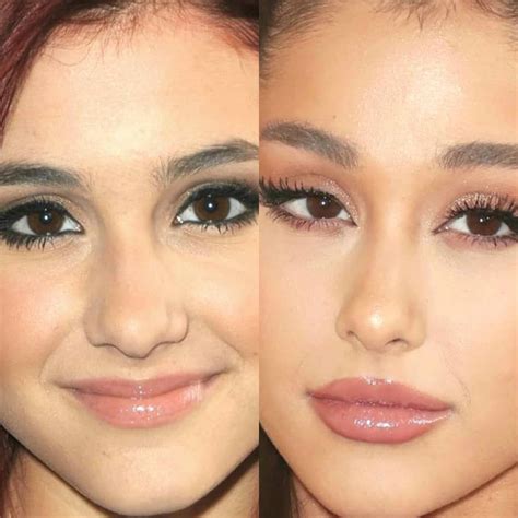 BeforeAfter on Instagram: "ARIANA GRANDE 2009 / 2018 #arianagrande #instafashion #instadaily # ...