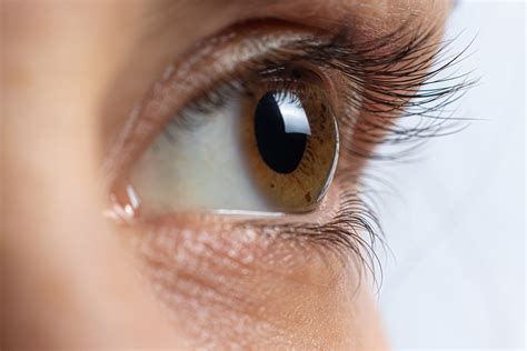 Eye Care Series: Symptoms of Keratoconus - Swagel Wootton Eye Institute