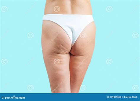 Female Buttocks with Cellulite on Pastel Blue Background Stock Photo - Image of healthy, back ...