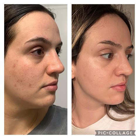 May 2021 vs today! Slow and steady progress for me, not giving up yet ...