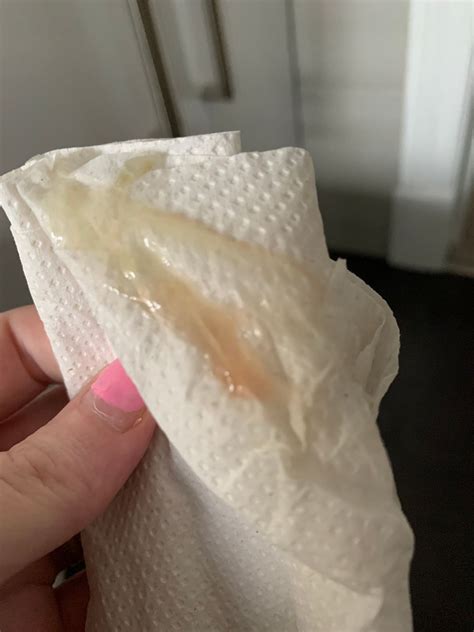 Blood Tinged Mucus Plug