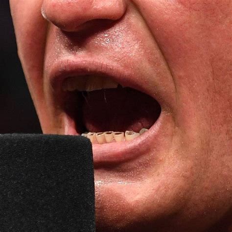 WWE and UFC star Brock Lesnar's teeth : r/WTF