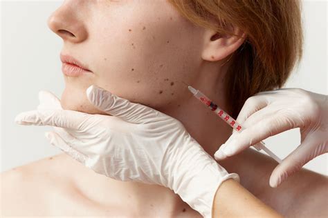 Botox For Facial Pain | Dr. Kaspo