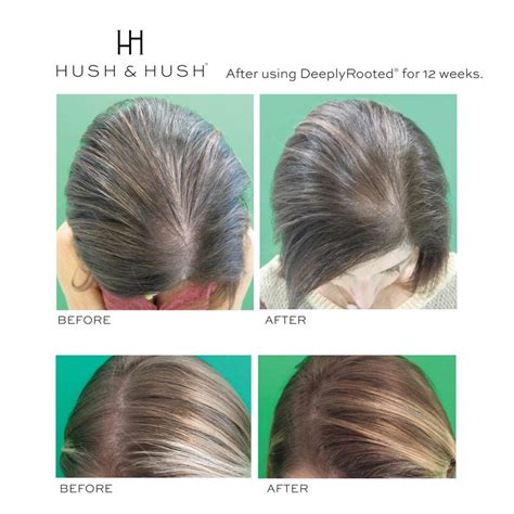 Deeply­Rooted™ - Hush and Hush