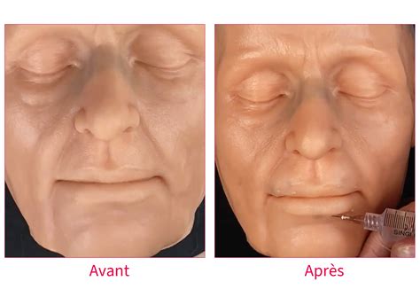 Cosmetic Injections Trainer - Simulateur d'injections cosmétiques I ...