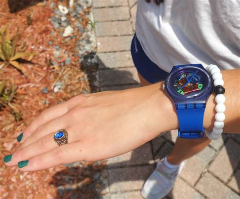[Swatch] The watch my girlfriend got as a child after brain surgery : r ...
