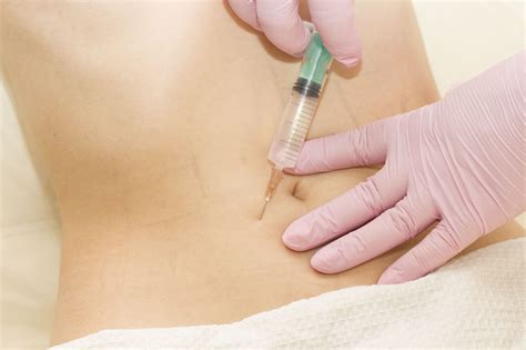 Optimal Semaglutide Injection Sites: Maximizing Comfort and Efficacy - Bmi Doctors