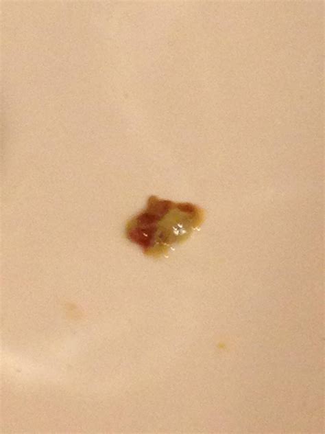 Coughing Up Green Mucus Cold at Brook Short blog