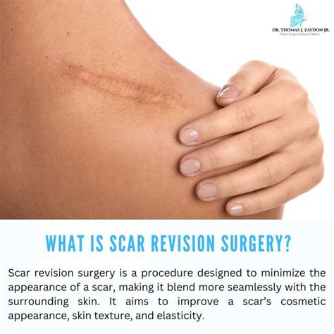 Scar revision surgery is a transformative procedure that can ...