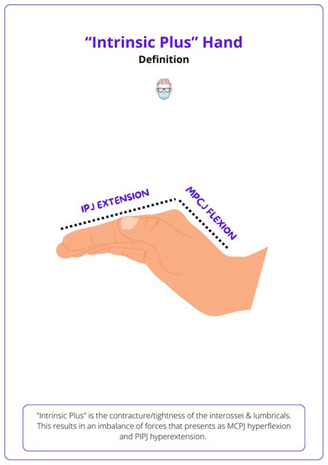 Intrinsic "Plus" Hand: Anatomy, Aetiology, and Management