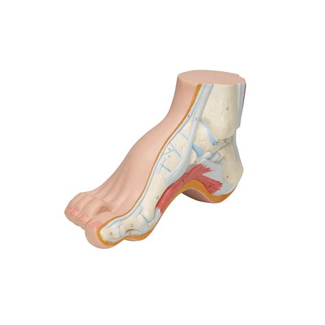 Hollow Foot (Pes Cavus) Model – Medisave UK