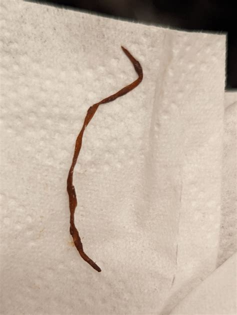 Help, stringy thing in poop (pic tmi, gross, NSFW) : r/AskDoctorSmeeee