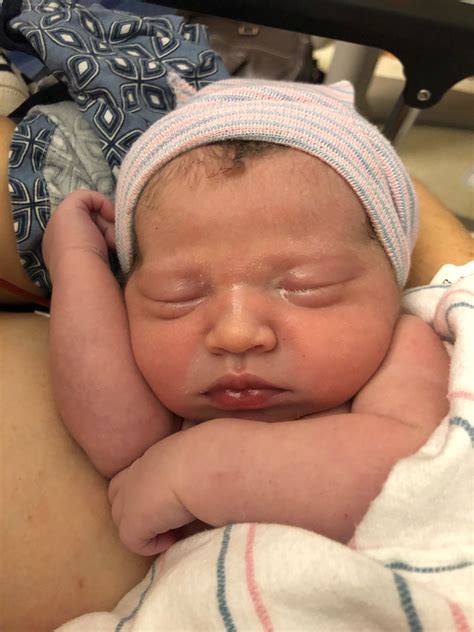 Baby Puffy Eyes After Birth at Dennis Fleming blog