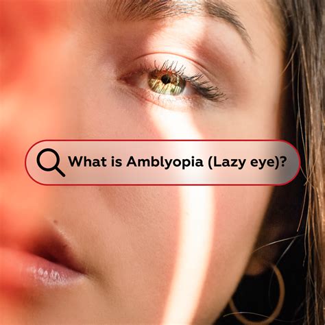 Pin on Spanish Eye Clinic