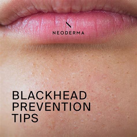 Blackhead Lip