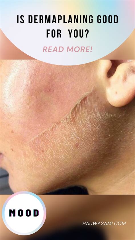 Why Is My Face Itchy After Dermaplaning at Tabitha Haney blog