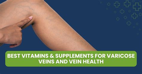 Why Are Veins Blue? The Truth Behind the Color of Your Veins - Palos ...