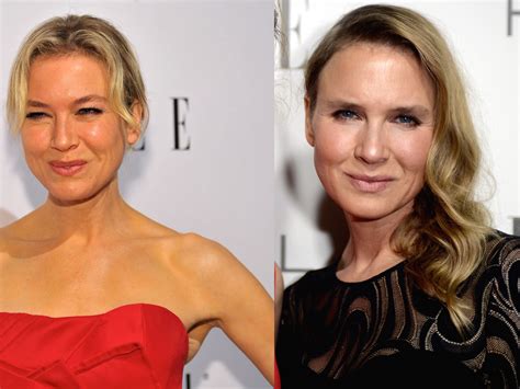 Cosmetic surgery new look renee zellweger now 323998-Renee zellweger ...