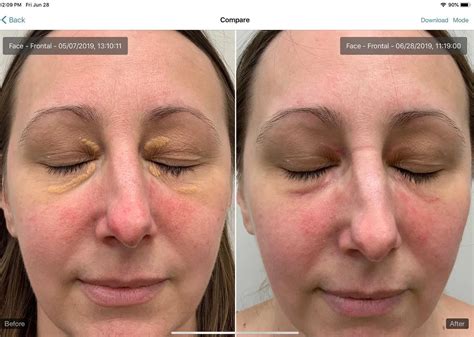 Tokarz Dermatology