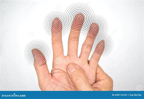 Tingling Sensation In Hands Of Asian Young Man With Diabetes. Sensory Neuropathy Problems. Hand ...