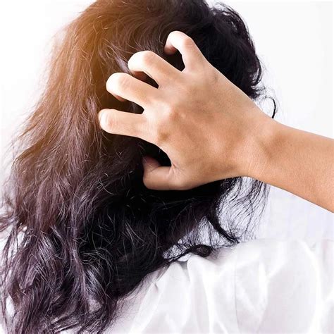 How to Control Oily Scalp: Expert Remedies Revealed
