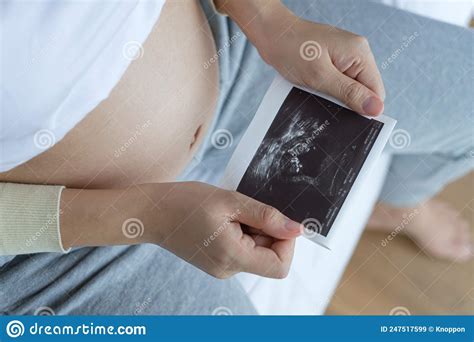 Asian Pregnant Woman Holding Ultrasound Film Scan of Baby Stock Image ...