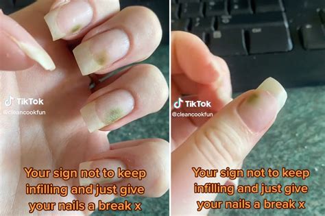 Why Is My Nail Green After Wearing Press On Nails at Veronica Green blog
