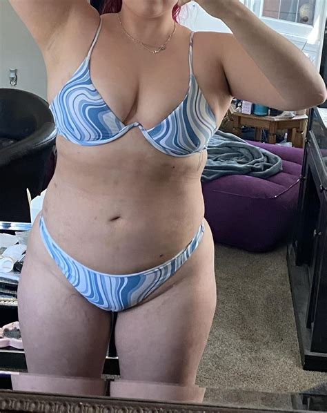 Front view before and 11 days after bbl (+lipo360), all thanks to Dr ...