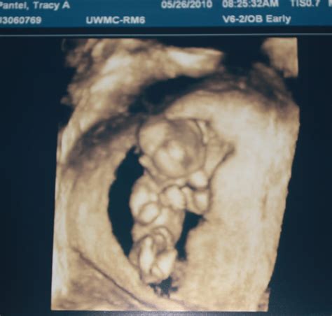 Pantel Family Blog: 12 week ultrasound