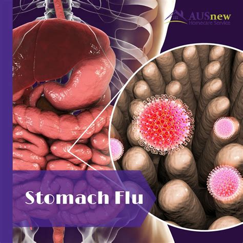 Stomach flu food – Artofit