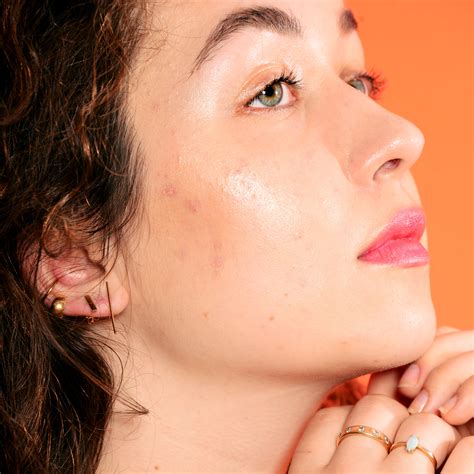 Face Breaking Out Around Mouth at Brenda Norris blog