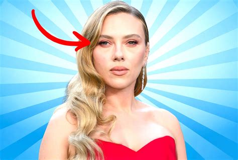 The Truth about Scarlett Johansson's Lazy Eye: Does She Have Strabismus? | Lazyeyefix
