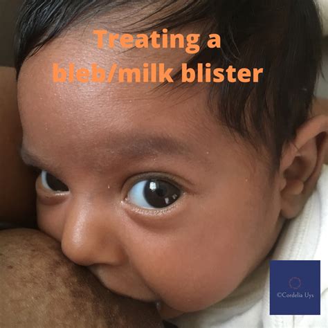 Milk Blister